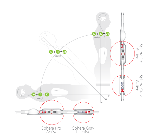 New SpheraGrav Antigravitacional